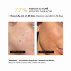 Federa Kaizen